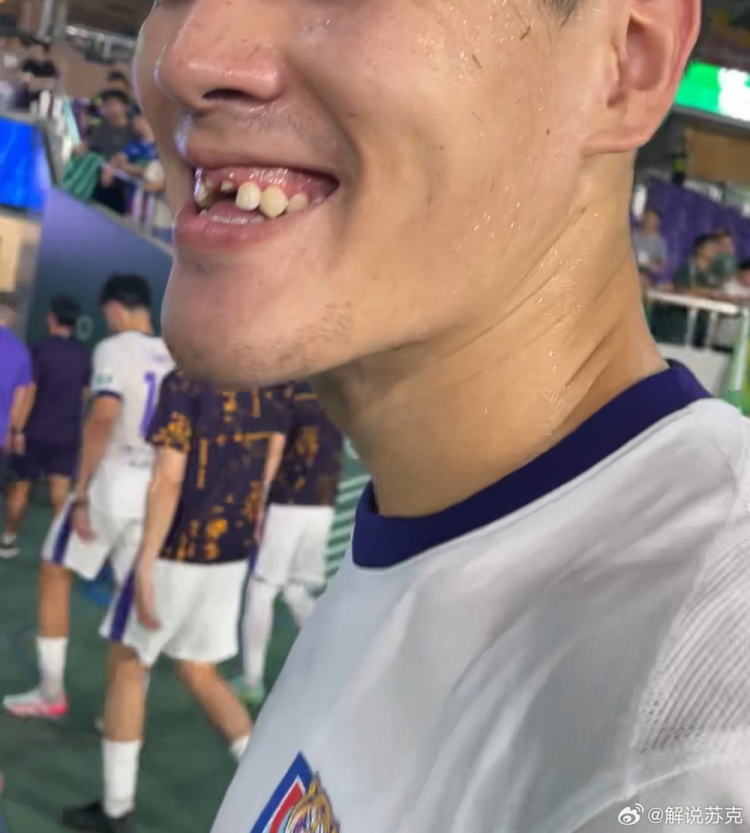 华体会官网-记者：王献均门牙留在了黄龙体育中心，很多人一起找都没找到